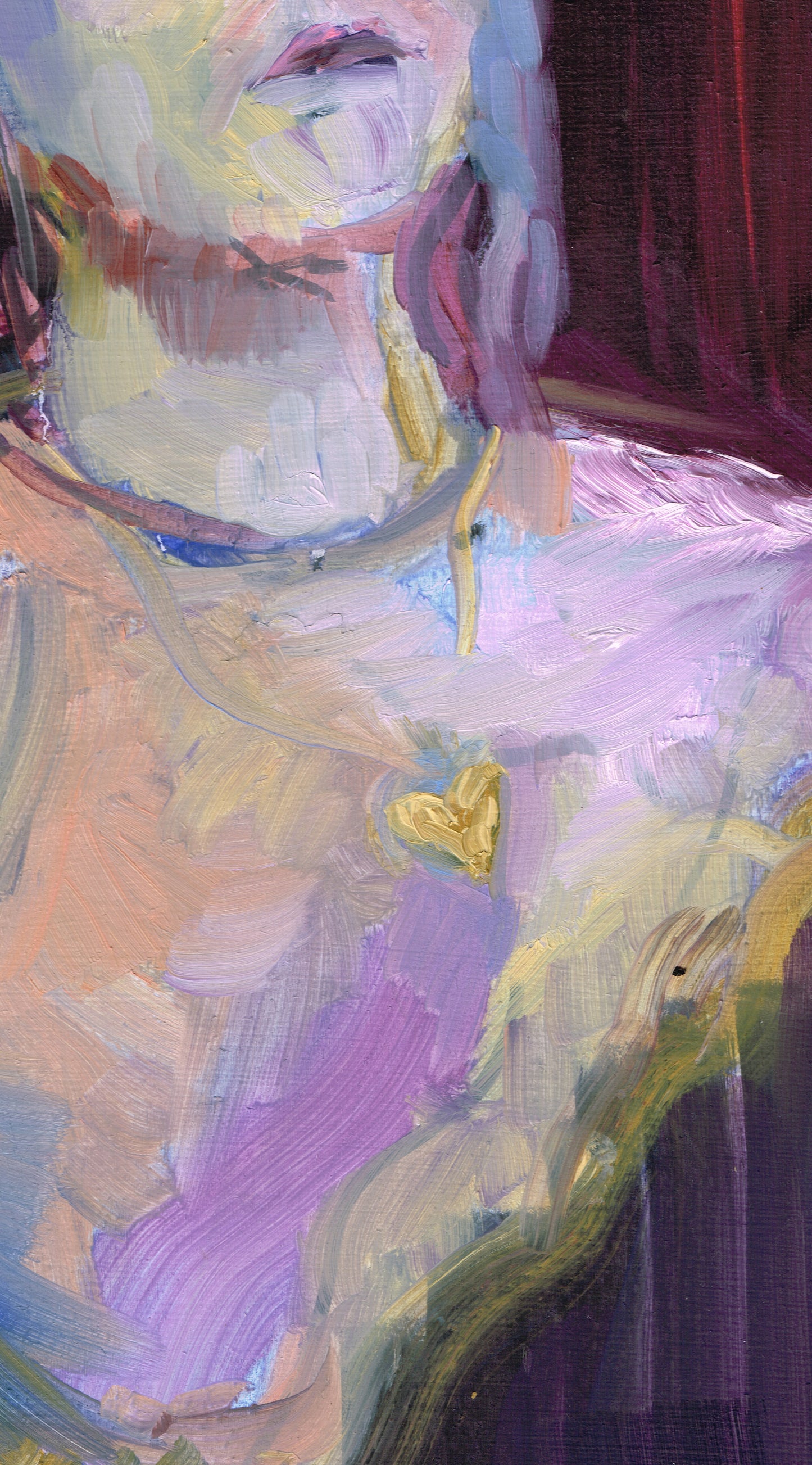 Heart Transplant, Hyacinth (Study)